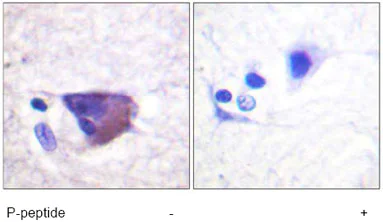Immunohistochemistry (Formalin/PFA-fixed paraffin-embedded sections) - Anti-Kv2.1/KCNB1 (phospho S567) antibody (AB61107)
