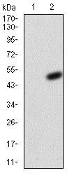Western blot - Anti-Kv4.2/KCND2 antibody [5B11B9] (AB204942)