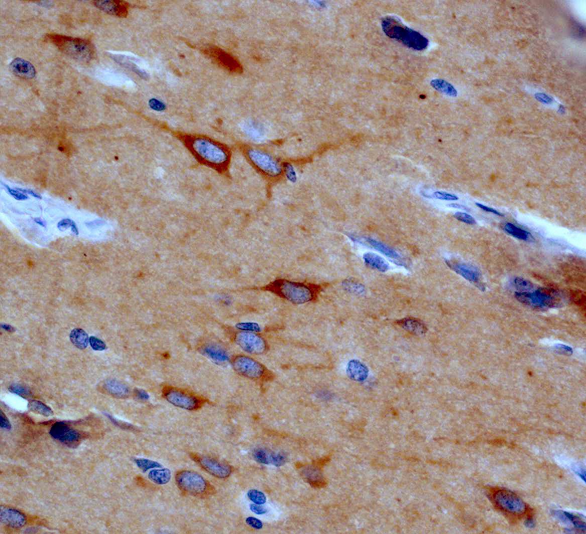 Immunohistochemistry (Formalin/PFA-fixed paraffin-embedded sections) - Anti-Kv4.2/KCND2 antibody [EP982Y] (AB46797)