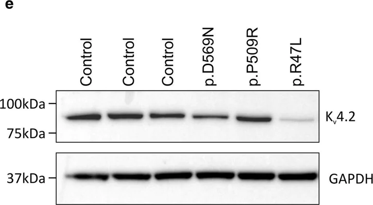 Western blot - Anti-Kv4.2/KCND2 antibody [EP982Y] (AB46797)