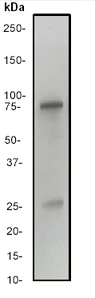 Western blot - Anti-Kv4.2/KCND2 antibody [EP982Y] (AB46797)