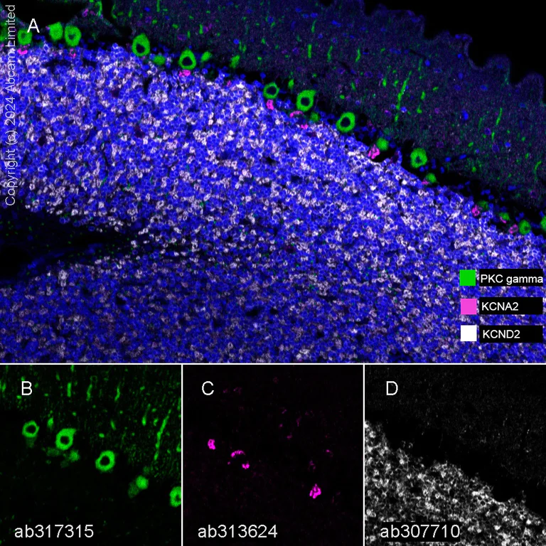 Multiplex immunohistochemistry - Anti-Kv4.2/KCND2 antibody [EPR26384-89] - BSA and Azide free (AB307711)