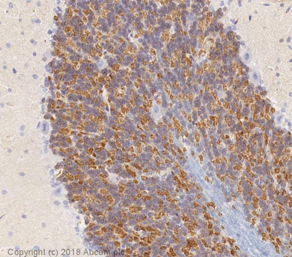 Immunohistochemistry (Formalin/PFA-fixed paraffin-embedded sections) - Anti-Kv4.2/KCND2 antibody [K57/1] (AB192762), expandable thumbnail