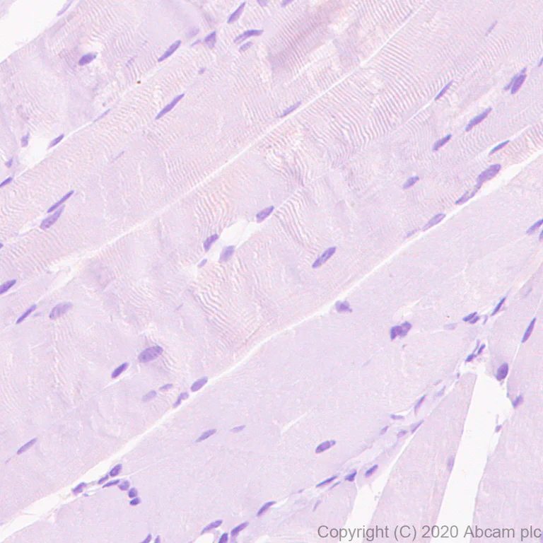 Immunohistochemistry (Formalin/PFA-fixed paraffin-embedded sections) - Anti-Kv4.3/KCND3 antibody [K75/41] (AB252538)