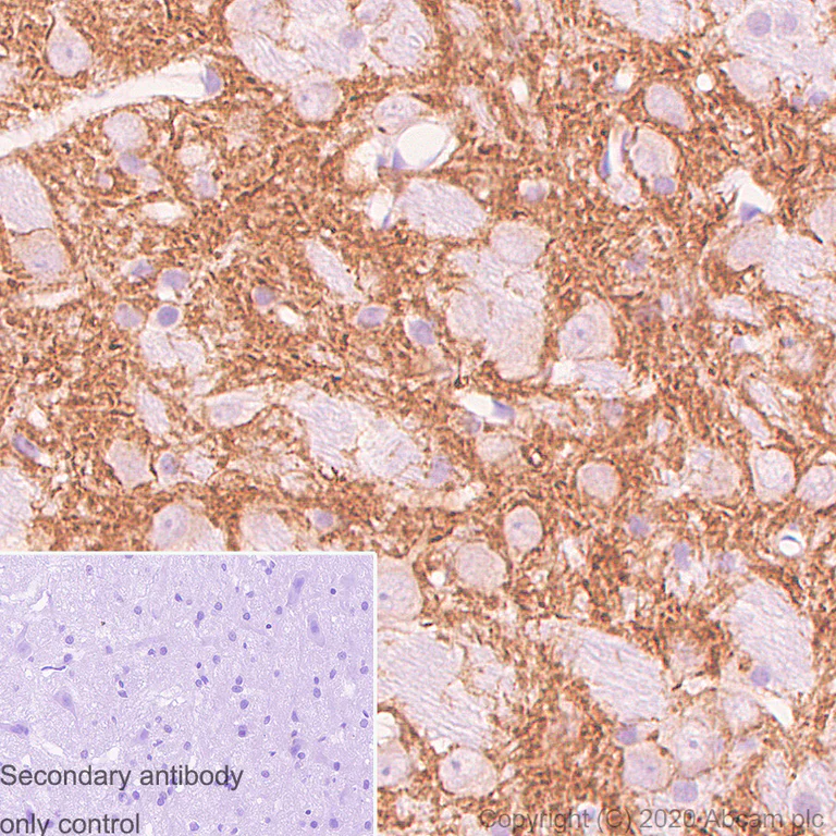 Immunohistochemistry (Formalin/PFA-fixed paraffin-embedded sections) - Anti-Kv4.3/KCND3 antibody [K75/41] - BSA and Azide free (AB254279)