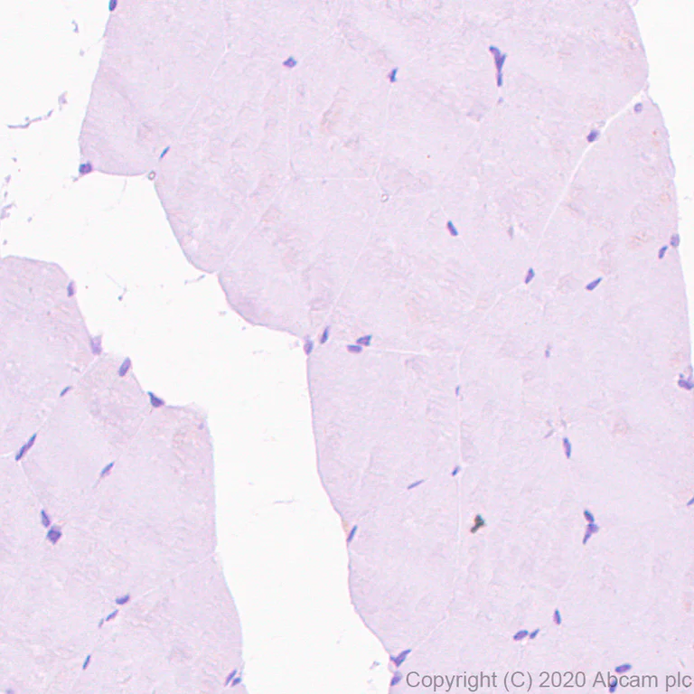 Immunohistochemistry (Formalin/PFA-fixed paraffin-embedded sections) - Anti-Kv4.3/KCND3 antibody [K75/41] - BSA and Azide free (AB254279)