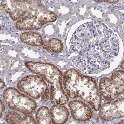 Immunohistochemistry (Formalin/PFA-fixed paraffin-embedded sections) - Anti-kynurenine 3-monooxygenase antibody (AB220922)