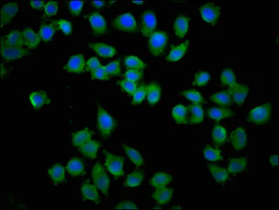 Immunocytochemistry/ Immunofluorescence - Anti-Kyphoscoliosis peptidase antibody (AB236741)