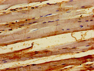 Immunohistochemistry (Formalin/PFA-fixed paraffin-embedded sections) - Anti-Kyphoscoliosis peptidase antibody (AB236741)