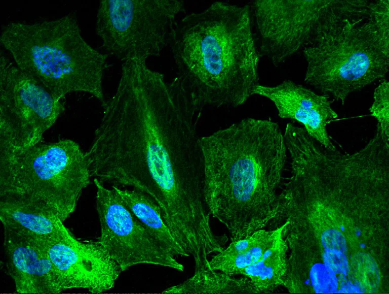 Immunocytochemistry - Anti-L-Kynurenine Hydrolase antibody [062] - BSA and Azide free (AB276053)
