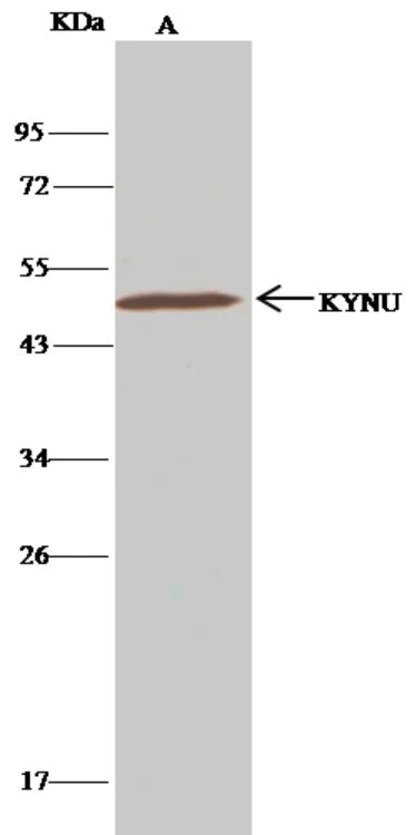 Immunoprecipitation - Anti-L-Kynurenine Hydrolase antibody [062] - BSA and Azide free (AB276053)