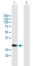 Western blot - Anti-l-Myc antibody (AB167315)