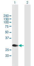 Western blot - Anti-l-Myc antibody (AB167315)