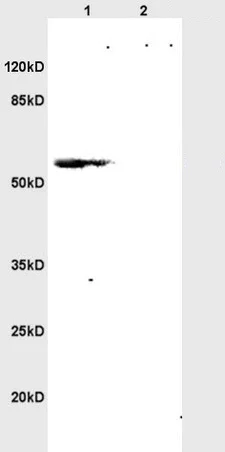 Western blot - Anti-L12 antibody (AB202978)
