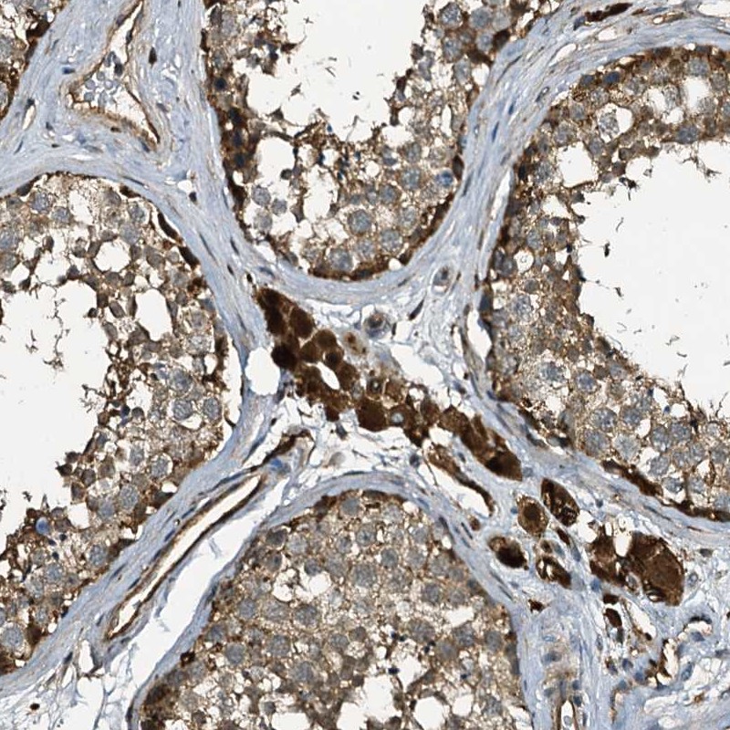 Immunohistochemistry (Formalin/PFA-fixed paraffin-embedded sections) - Anti-L17 antibody (AB254850)