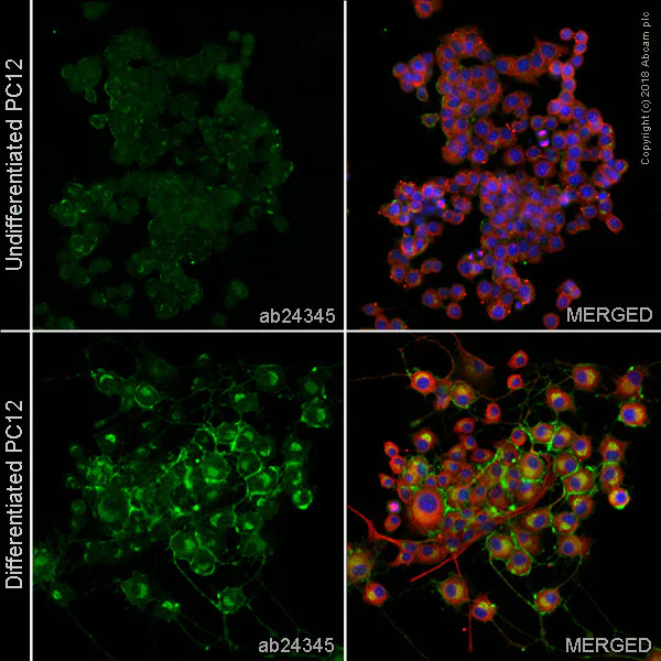 Immunocytochemistry - Anti-L1CAM antibody [2C2] (AB24345)