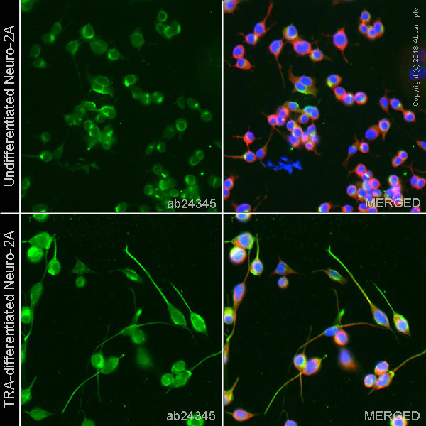 Immunocytochemistry - Anti-L1CAM antibody [2C2] (AB24345)