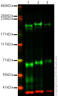 Western blot - Anti-L1CAM antibody [2C2] (AB24345)