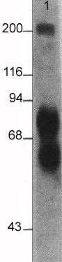 Western blot - Anti-L1CAM antibody [2C2] (AB24345)