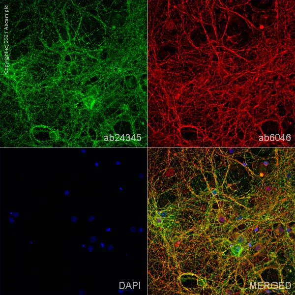 Immunocytochemistry - Anti-L1CAM antibody [2C2] - BSA and Azide free (AB264526)