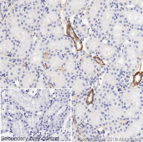 Immunohistochemistry (Formalin/PFA-fixed paraffin-embedded sections) - Anti-L1CAM antibody [2C2] - BSA and Azide free (AB264526)