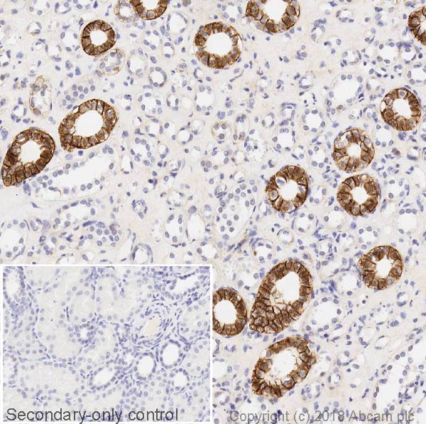 Immunohistochemistry (Formalin/PFA-fixed paraffin-embedded sections) - Anti-L1CAM antibody [2C2] - BSA and Azide free (AB264526)
