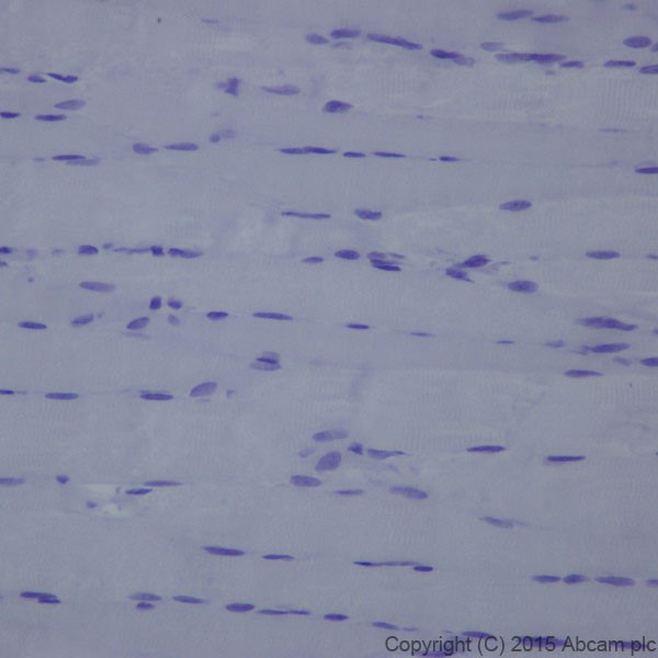 Immunohistochemistry (Formalin/PFA-fixed paraffin-embedded sections) - Anti-L1CAM antibody [EPR18750] (ab208155), expandable thumbnail