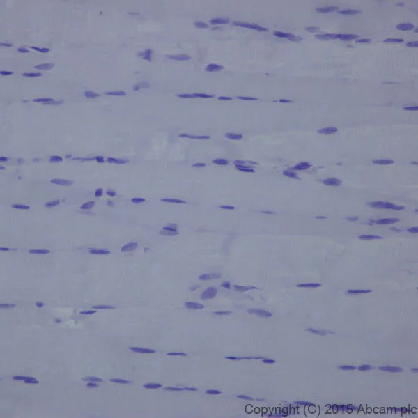 Immunohistochemistry (Formalin/PFA-fixed paraffin-embedded sections) - Anti-L1CAM antibody [EPR18750] (AB208155)