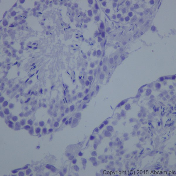 Immunohistochemistry (Formalin/PFA-fixed paraffin-embedded sections) - Anti-L1CAM antibody [EPR18750] (ab208155), expandable thumbnail