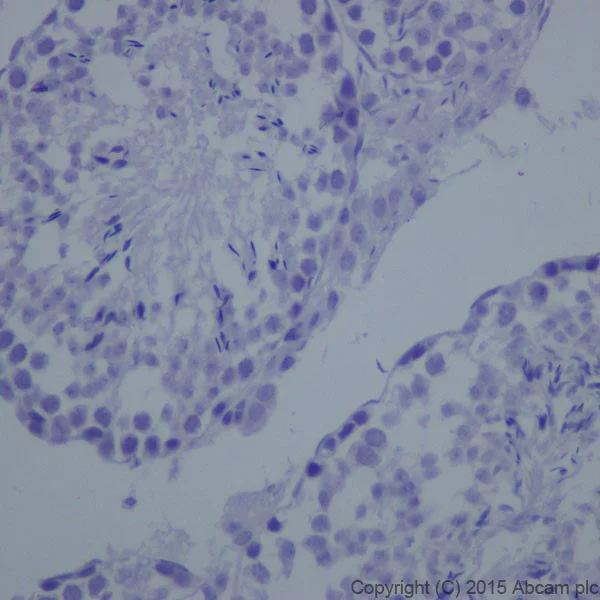 Immunohistochemistry (Formalin/PFA-fixed paraffin-embedded sections) - Anti-L1CAM antibody [EPR18750] (AB208155)