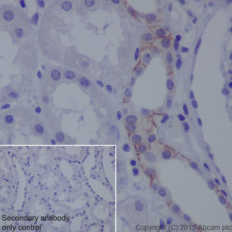 Immunohistochemistry (Formalin/PFA-fixed paraffin-embedded sections) - Anti-L1CAM antibody [EPR18750] (ab208155), expandable thumbnail