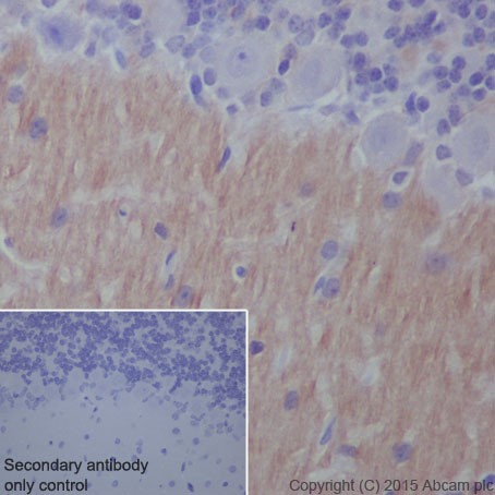 Immunohistochemistry (Formalin/PFA-fixed paraffin-embedded sections) - Anti-L1CAM antibody [EPR18750] (ab208155), expandable thumbnail