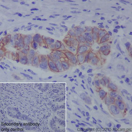 Immunohistochemistry (Formalin/PFA-fixed paraffin-embedded sections) - Anti-L1CAM antibody [EPR18750] (AB208155)