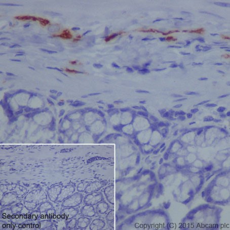 Immunohistochemistry (Formalin/PFA-fixed paraffin-embedded sections) - Anti-L1CAM antibody [EPR18750] (ab208155), expandable thumbnail