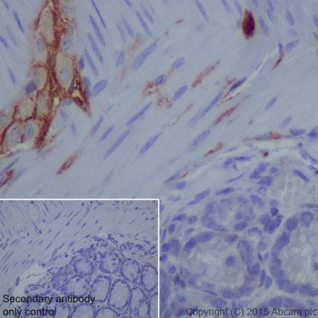Immunohistochemistry (Formalin/PFA-fixed paraffin-embedded sections) - Anti-L1CAM antibody [EPR18750] (ab208155), expandable thumbnail