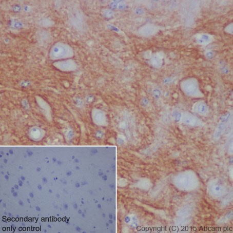 Immunohistochemistry (Formalin/PFA-fixed paraffin-embedded sections) - Anti-L1CAM antibody [EPR18750] (AB208155), expandable thumbnail