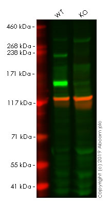 Western blot - Anti-L1CAM antibody [EPR18750] (AB208155), expandable thumbnail