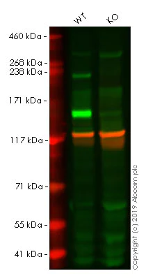 Western blot - Anti-L1CAM antibody [EPR18750] (AB208155)