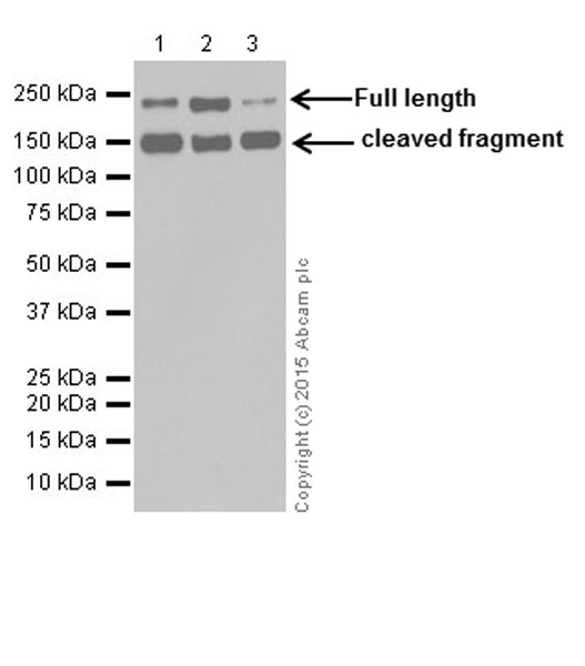 Western blot - Anti-L1CAM antibody [EPR18750] (AB208155), expandable thumbnail