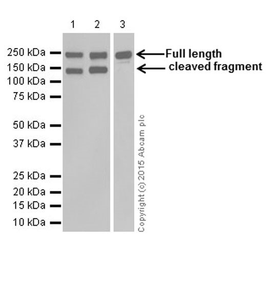 Western blot - Anti-L1CAM antibody [EPR18750] (AB208155), expandable thumbnail