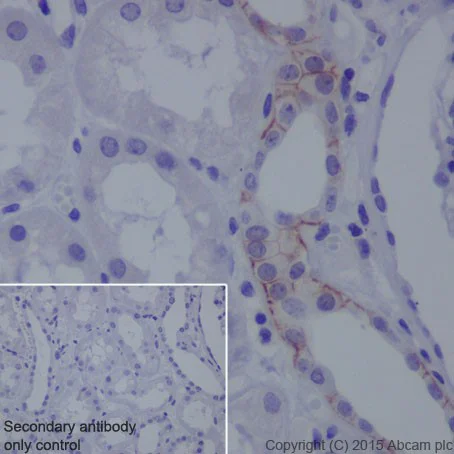 Immunohistochemistry (Formalin/PFA-fixed paraffin-embedded sections) - Anti-L1CAM antibody [EPR18750] - BSA and Azide free (AB271982)