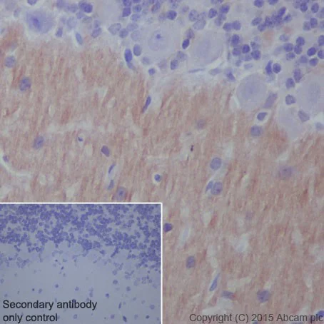 Immunohistochemistry (Formalin/PFA-fixed paraffin-embedded sections) - Anti-L1CAM antibody [EPR18750] - BSA and Azide free (AB271982)