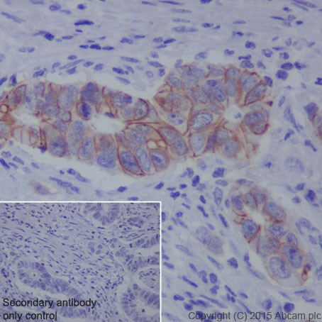 Immunohistochemistry (Formalin/PFA-fixed paraffin-embedded sections) - Anti-L1CAM antibody [EPR18750] - BSA and Azide free (ab271982), expandable thumbnail