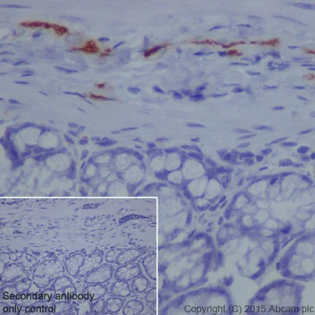 Immunohistochemistry (Formalin/PFA-fixed paraffin-embedded sections) - Anti-L1CAM antibody [EPR18750] - BSA and Azide free (AB271982)