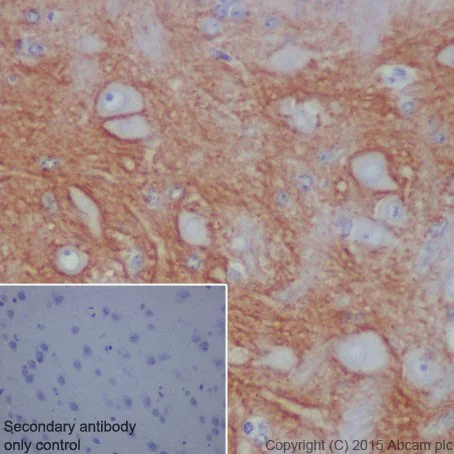 Immunohistochemistry (Formalin/PFA-fixed paraffin-embedded sections) - Anti-L1CAM antibody [EPR18750] - BSA and Azide free (AB271982)
