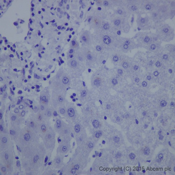 Immunohistochemistry (Formalin/PFA-fixed paraffin-embedded sections) - Anti-L1CAM antibody [EPR18750] - Low endotoxin, Azide free (AB213611)