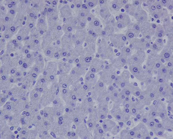 Immunohistochemistry (Formalin/PFA-fixed paraffin-embedded sections) - Anti-L1CAM antibody [EPR18998] - BSA and Azide free (AB240261)