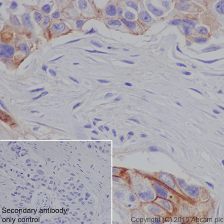 Immunohistochemistry (Formalin/PFA-fixed paraffin-embedded sections) - Anti-L1CAM antibody [EPR18998] - BSA and Azide free (AB240261), expandable thumbnail