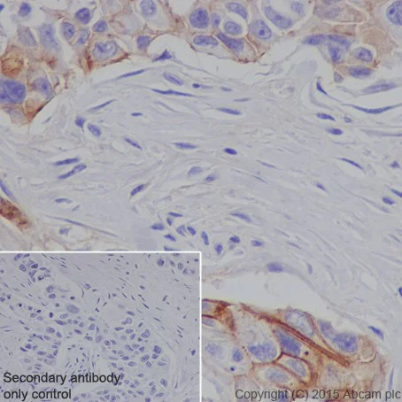 Immunohistochemistry (Formalin/PFA-fixed paraffin-embedded sections) - Anti-L1CAM antibody [EPR18998] - BSA and Azide free (AB240261)
