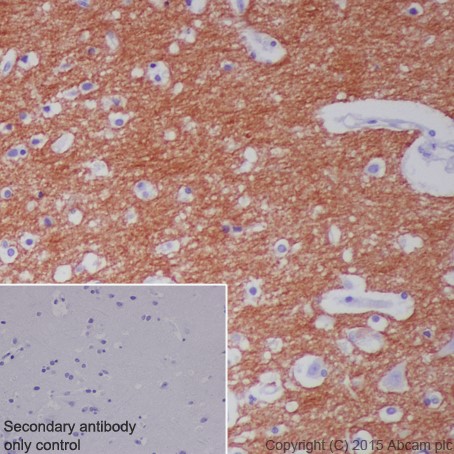 Immunohistochemistry (Formalin/PFA-fixed paraffin-embedded sections) - Anti-L1CAM antibody [EPR18998] - BSA and Azide free (AB240261), expandable thumbnail